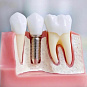 Стоматологические расх. ортопедия и зуботехническое